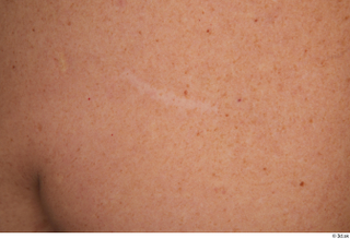  Steve Q chest scar skin 0002.jpg